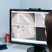 Brakuje radiologów? Jak małe szpitale radzą sobie dzięki telemedycynie