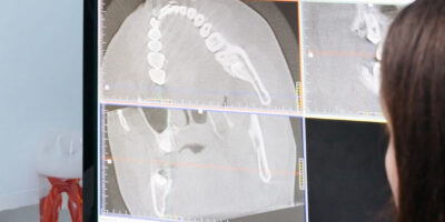 Brakuje radiologów? Jak małe szpitale radzą sobie dzięki telemedycynie
