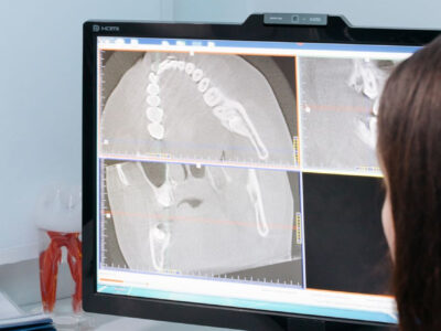 Brakuje radiologów? Jak małe szpitale radzą sobie dzięki telemedycynie