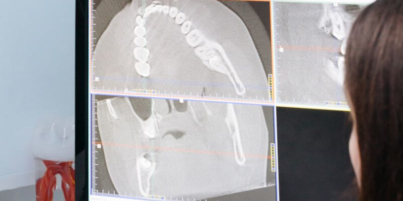 Brakuje radiologów? Jak małe szpitale radzą sobie dzięki telemedycynie