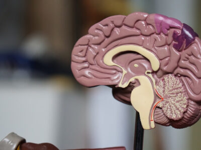 Pierwsze objawy guza mózgu - jakie bóle głowy wymagają pilnej diagnostyki obrazowej