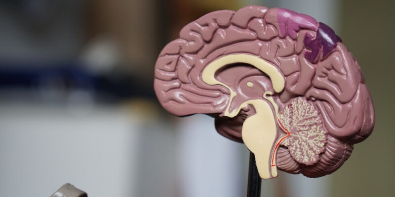 Pierwsze objawy guza mózgu - jakie bóle głowy wymagają pilnej diagnostyki obrazowej